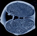 Fossil Embryo Cross Section from Doushantuo Formation