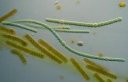 cyanobacteria